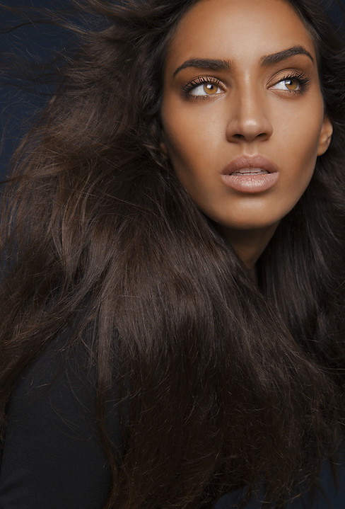 model for hyaluronidase dermal filler dissolving page dani louise aesthetics sidcup kent