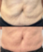 Tummy Tightening