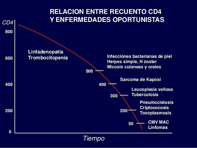 infección del vih y de los ojos
