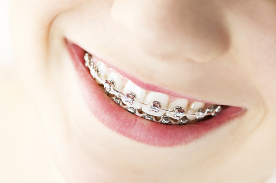AdobeStock_40903271.jpeg