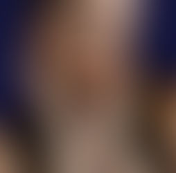 Caucasian woman with freckles, close-up of face, representing healthy skin