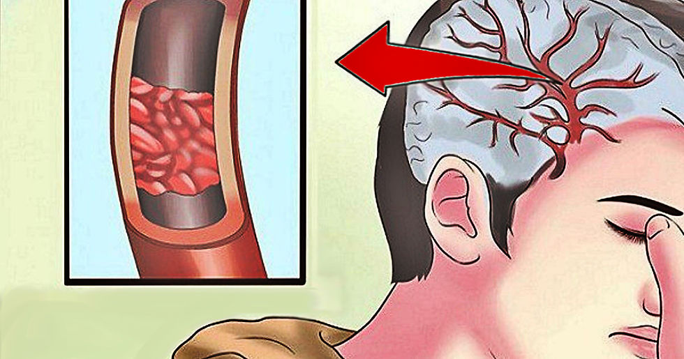 32 Signs You Need More Magnesium