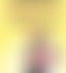 Natural Remedy for Sagging Eyelids You Will See Results In 2 Minutes!!!