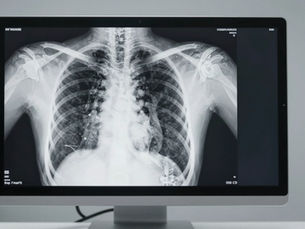 X-Ray Cost in Dubai & Sharjah (2026): From AED 130