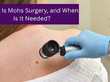 What Is Mohs Surgery, and When Is It Needed?
