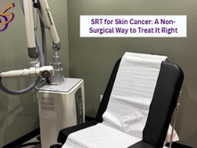 SRT for Skin Cancer: A Non-Surgical Way to Treat It Right