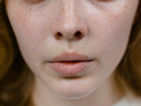 Rosacea, Sensitive Skin & Finding a Routine That Doesn’t Fight Back