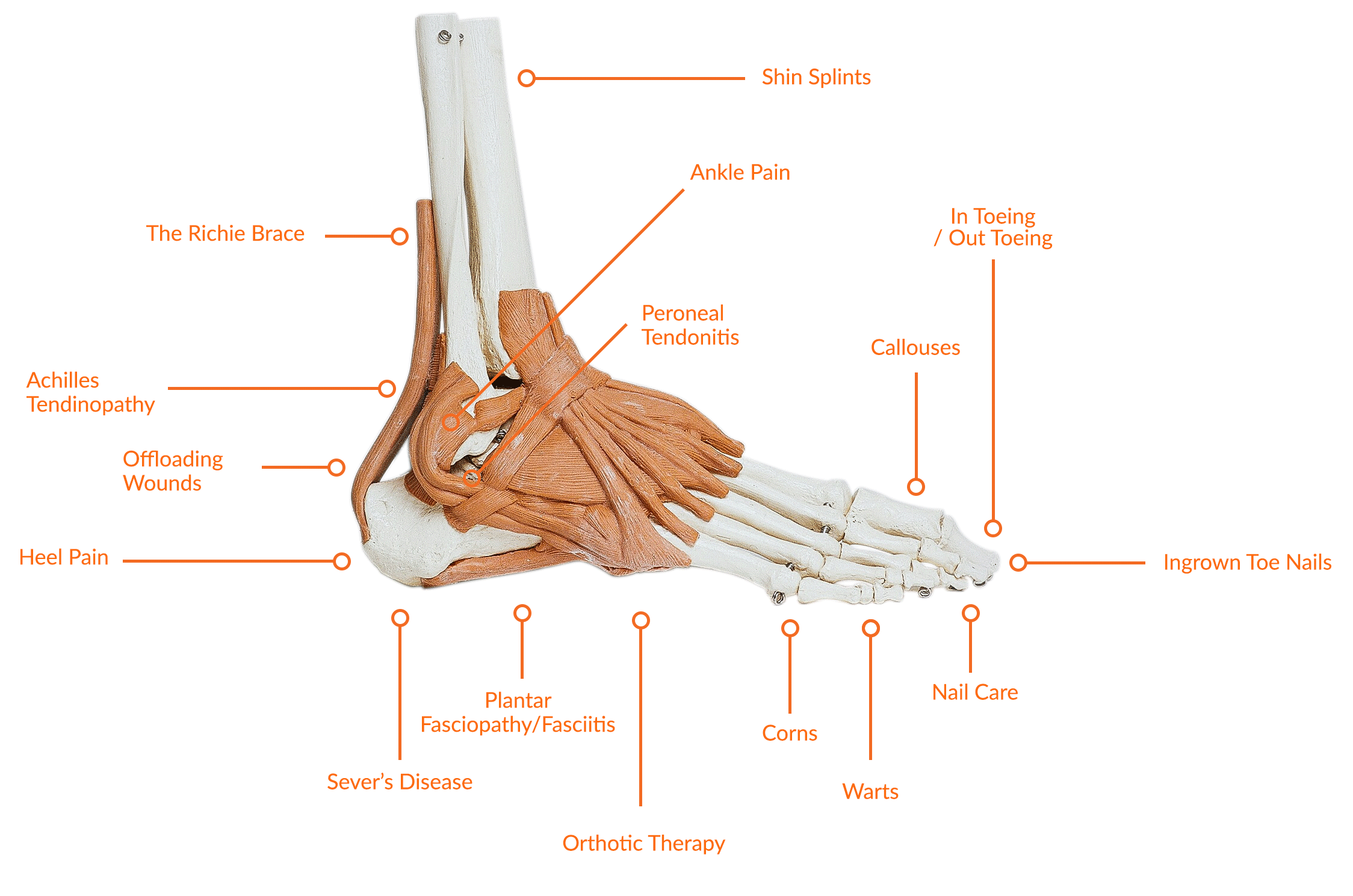 In-Home-Podiatry-Adelaide-treatment-Image-diagram-WEB-2.gif