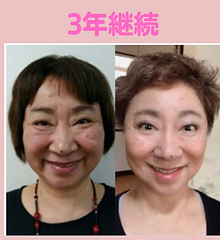 3年継続 (1).png