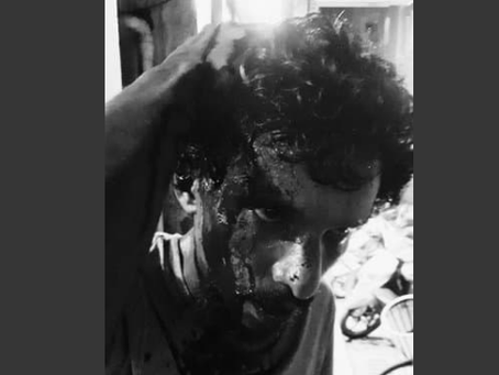 ވަޅިޖަހައި މީހަކު ޒަޚަމްކޮށްލައިފި