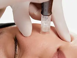 treatment-23-Pro-Nano-Infusion.webp