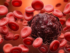 Kansarka Iyo Dhibaatu Uu Kuhaayo Bulshada Somaaliyeed