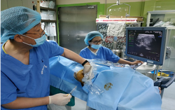 Bexcore surgery