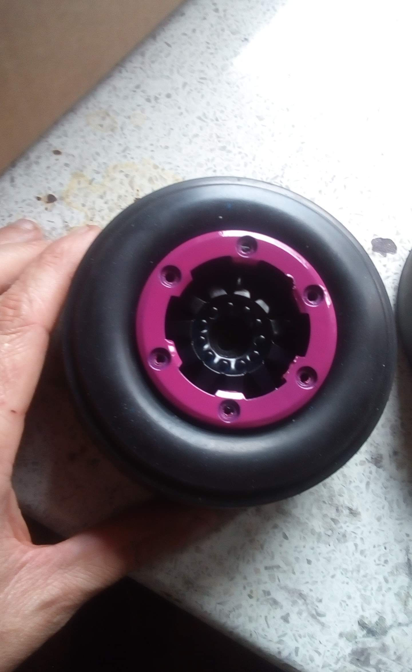 Ring of hope (Cancer research fundraising tool)