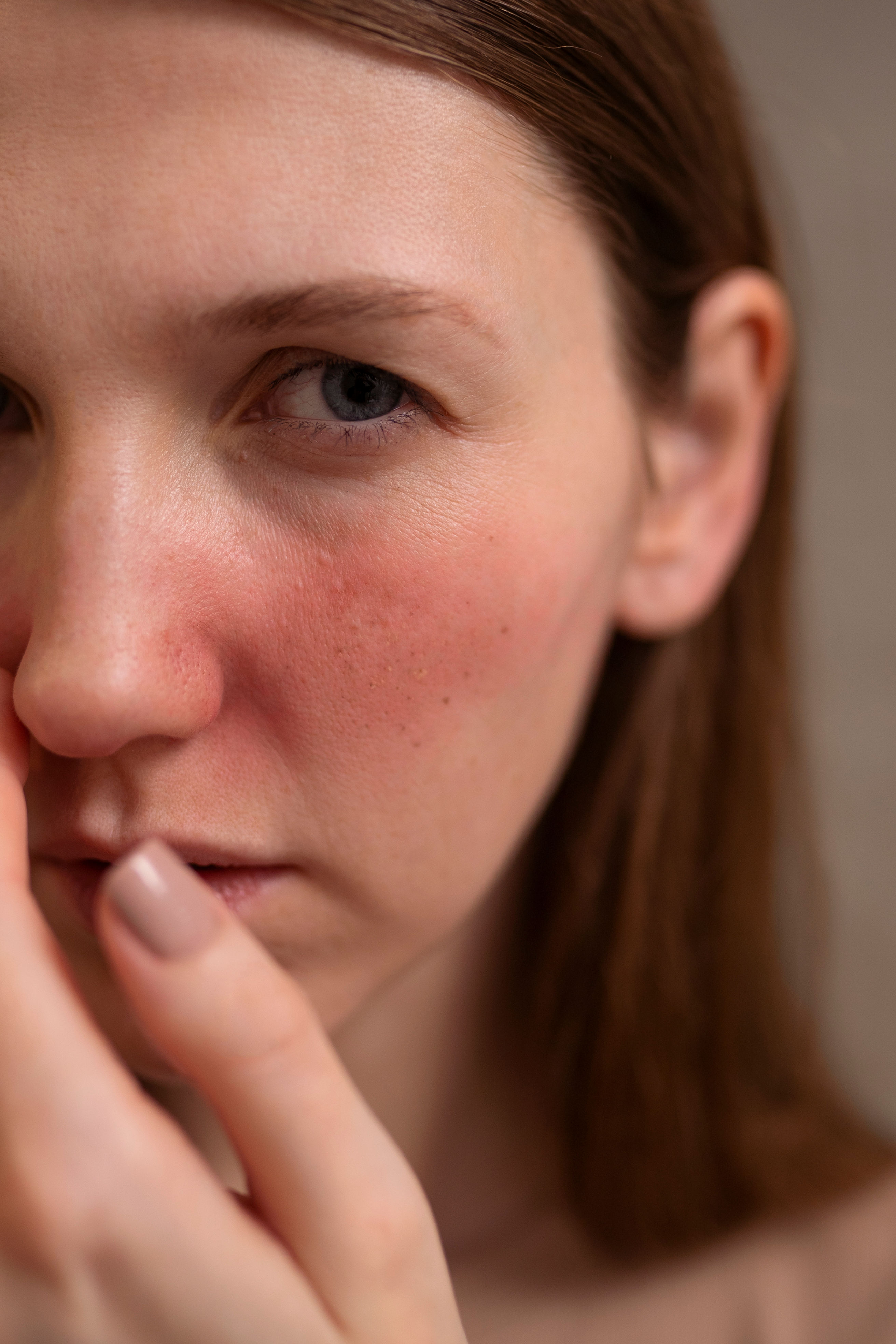 Inflamed Compromised Skin Barrier