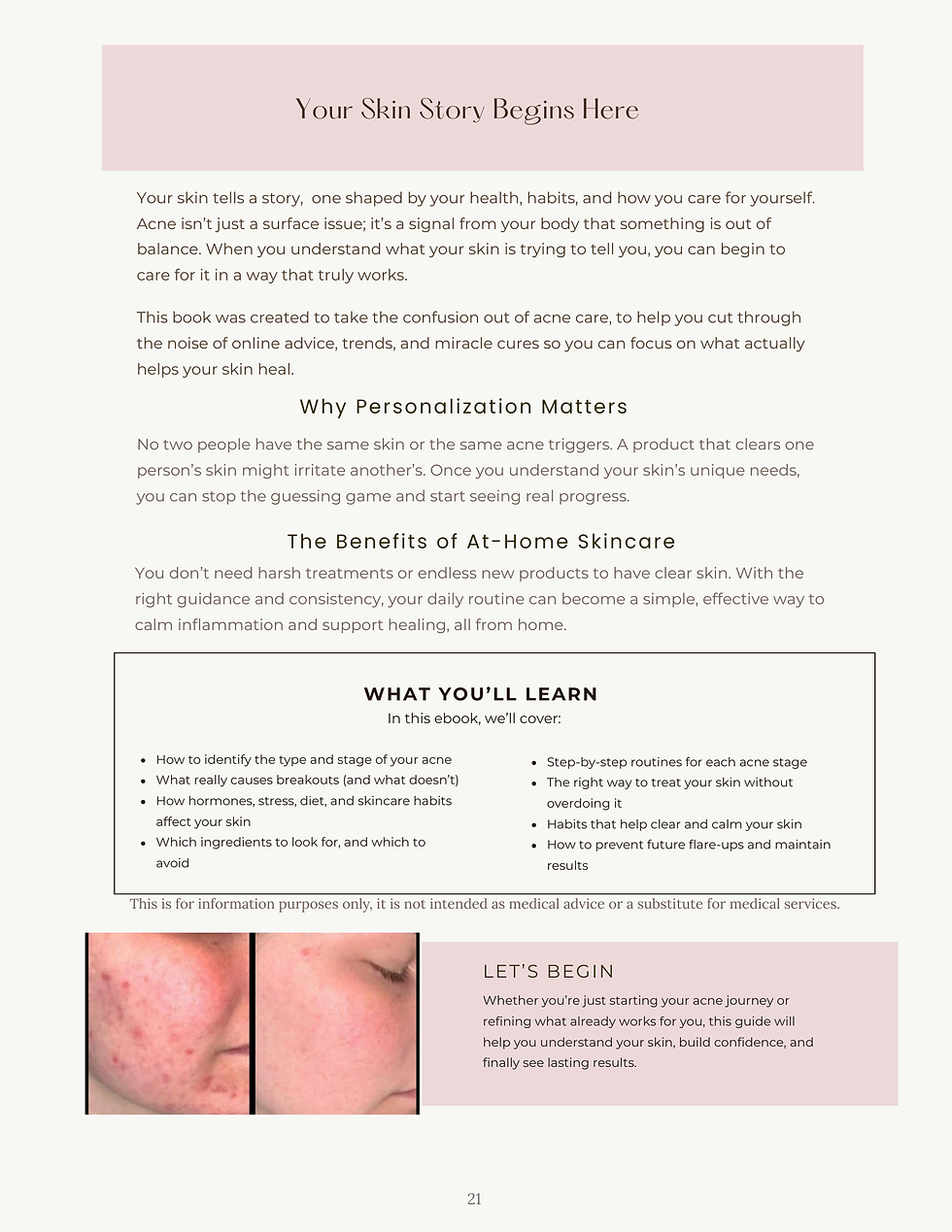 Thumbnail: Begin Here, has a list of  what you will learn in this eBook.