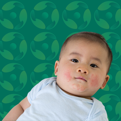 Paediatric Dermatology - Cura Health Belfast 