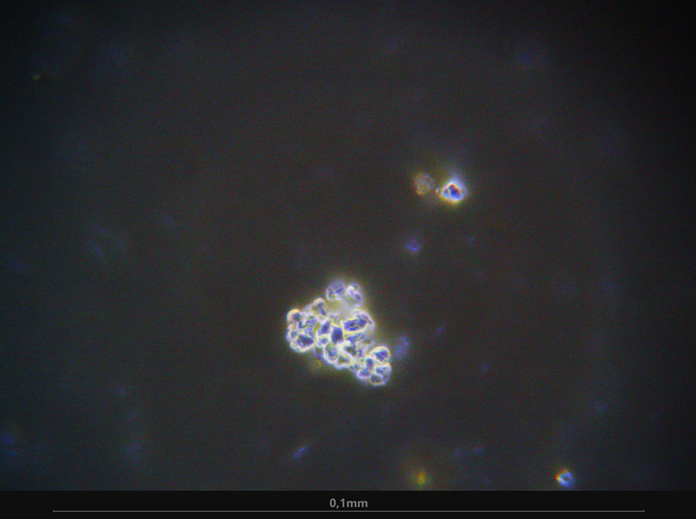 H - Ongle - 1000 X - 01.jpg