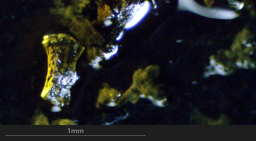 Urine à 6 mois - 40 X - 02 - A - zoom.jpg