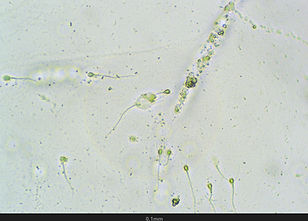 Spermatozoide - 400 X - Fond Standard - Obj. Plan.jpg