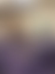 Ventajas de la cirugía de mínima invasion