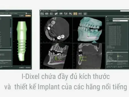 phan mem thiet ke nha khoa: giai phap cong nghe dot pha trong nganh nha khoa