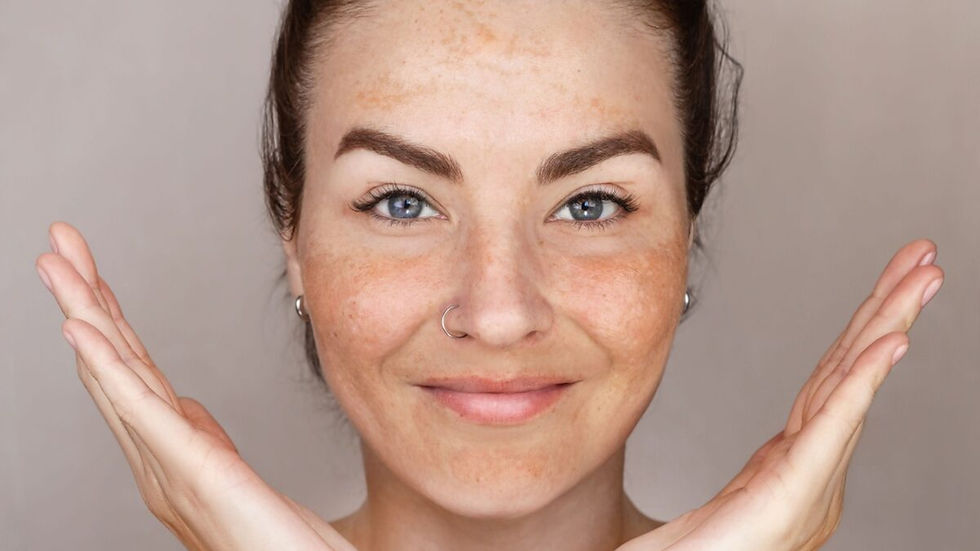 Le macchie post estate