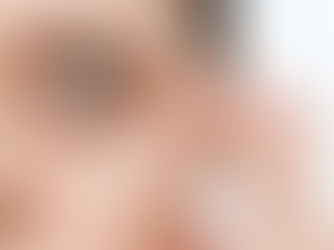 le occhiaie scure sono tra gli inestetismi più complessi e spesso non dipendono solo dalla stanchezza. Nel 2025 l’approccio è multifattoriale e personalizzato.