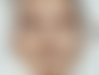 Face Smart Rejuvenation