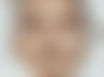 Face Smart Rejuvenation