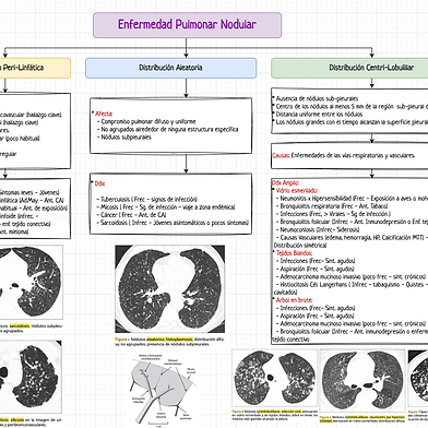 Enfermedad Pulmonar Nodular