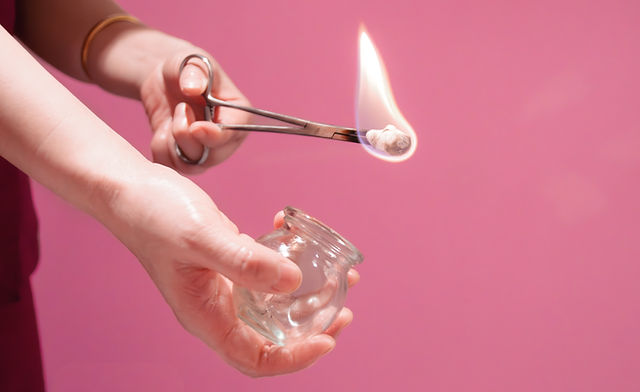 Cupping fire.jpg