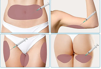 LIPOGEN A4.jpg
