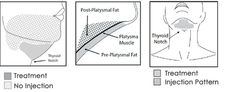 LIPOGEN A4.jpg