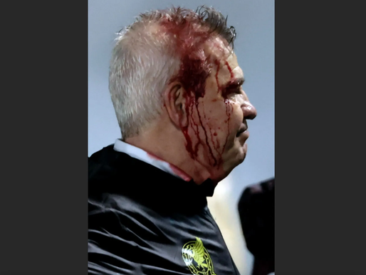 Concacaf investigará agresión contra Javier Aguirre en Honduras