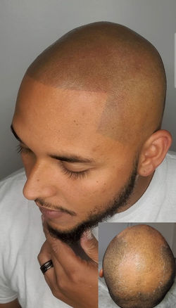 Before & After