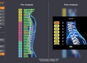 Full Spine Display.png