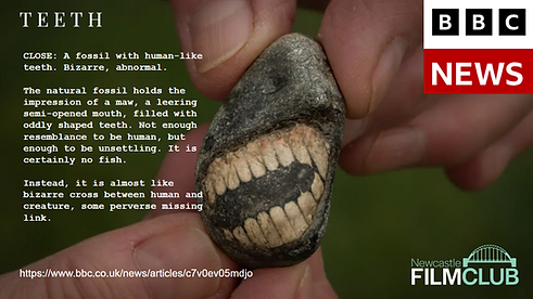 Teeth-Slide9.PNG