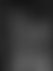 Finding the Root of Back Pain – It’s Not What You Think