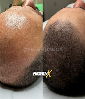 19-regenx-cheveux.png