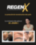 REGEN X CALVITIE LA RÉUNION