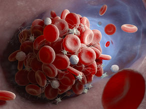 How to conduct a Thrombosis Assay using Cellix's VenaFlux Basic setup with ExiGo pump