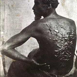 Existe una fotografía de 1863 que conviene mirar antes de continuar. Un hombre de espaldas, sentado en una silla, con esa postura ambigua de quien posa para la historia aunque nadie le haya preguntado si quería. Circuló por todo el territorio de los Estados Unidos durante la Guerra Civil. Se reprodujo en periódicos, en panfletos abolicionistas, en las manos de quienes necesitaban una imagen que dijera lo que las palabras no alcanzaban a decir. Fue, en el lenguaje de su época, viral.