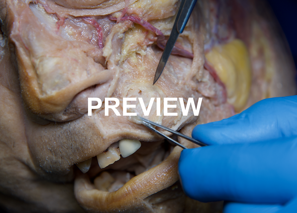 Thumbnail: Deep facial anatomy specimen from CHANG & FILLER’S Anatomy of Facial Aesthetics Volume II