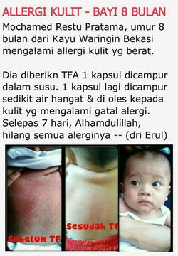 Alergi Bayi.jpg