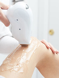 Laser Haarentfernung Better Skin Studio Luzern.jpg