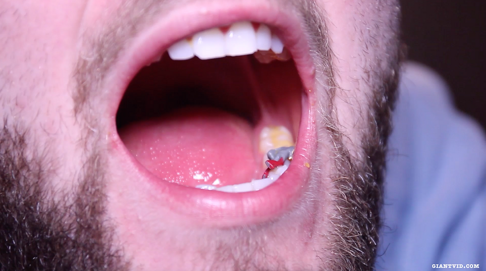 Thumbnail: Tiny Toothache ft Colin