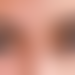 El procedimiento quirúrgico que puede cambiar permanentemente el color de los ojos; ¿tiene riesgos?