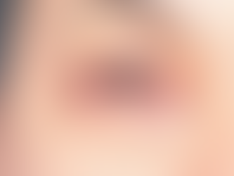 Aumentan 20% casos de conjuntivitis en Tampico