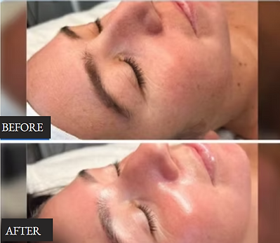 Signature Meso Glow.png